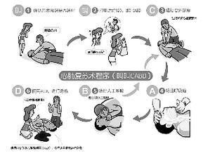 突发心源性骤停，心源性心脏骤停的原因包括下列哪项 